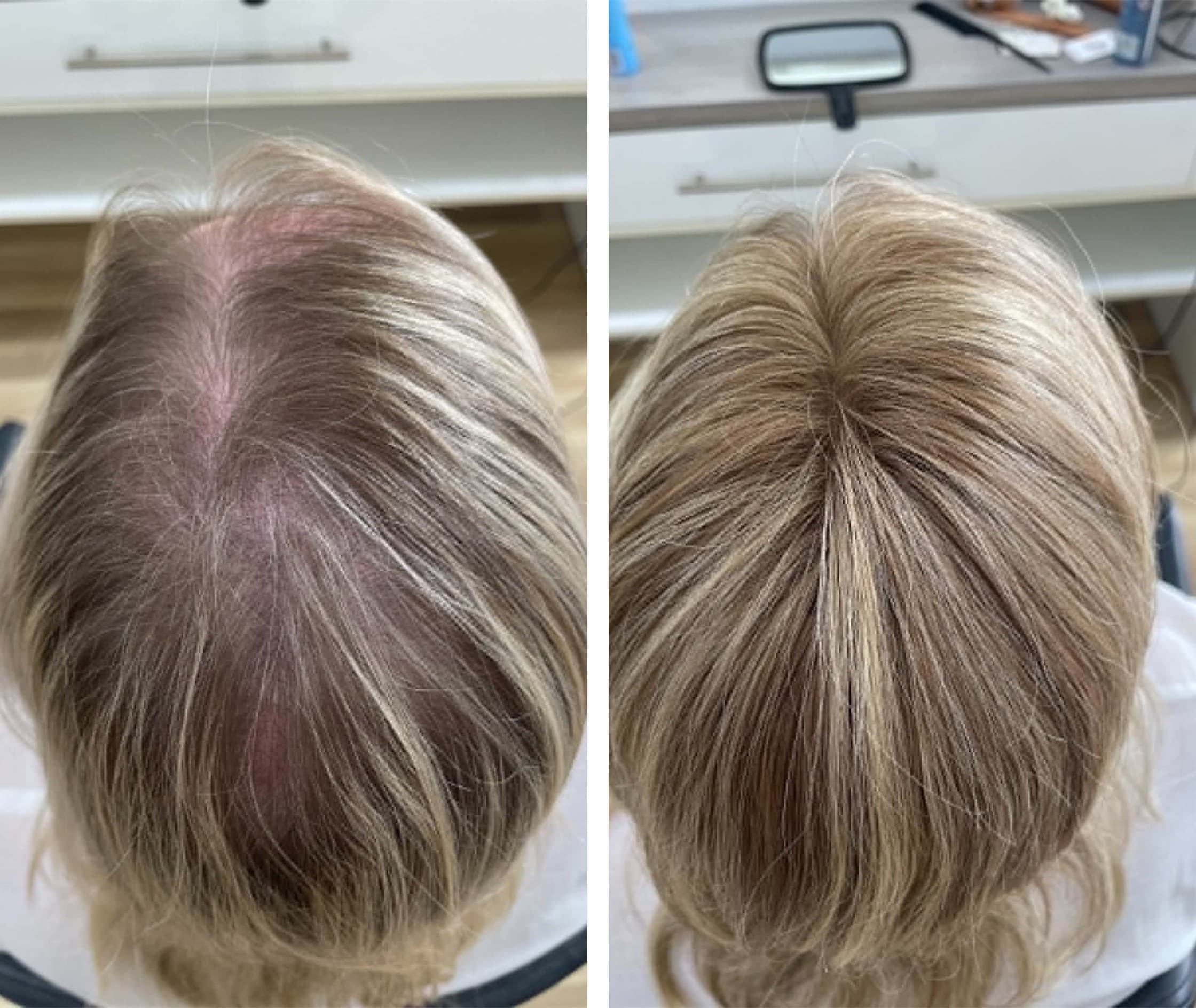 Highlights and volume, back view